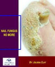 nailfungusnomores
